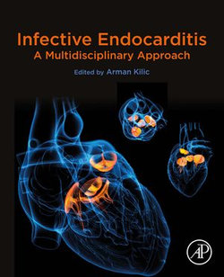 Infective Endocarditis