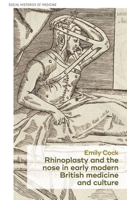 Rhinoplasty and the nose in early modern British medicine and culture