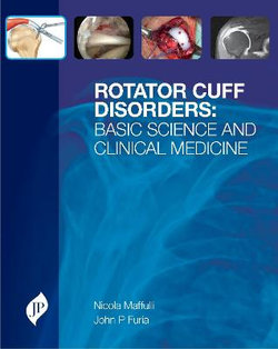 Rotator Cuff Disorders