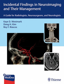 Incidental Findings in Neuroimaging and Their Management