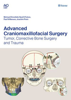 Advanced Craniomaxillofacial Surgery