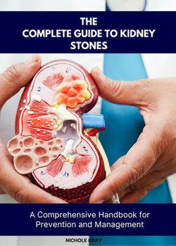 The Complete Guide to Kidney Stones