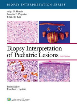 Biopsy Interpretation of Pediatric Lesions