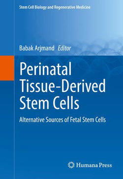 Perinatal Tissue-Derived Stem Cells