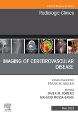 Imaging of Cerebrovascular Disease, An Issue of Radiologic Clinics of North America, E-Book