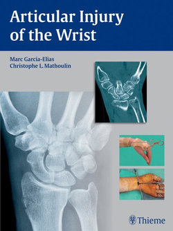 Articular Injury of the Wrist