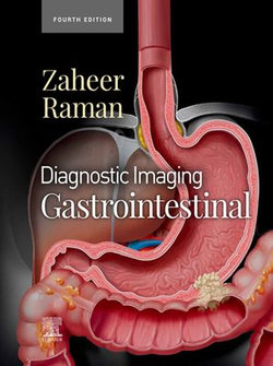 Diagnostic Imaging: Gastrointestinal - E-Book