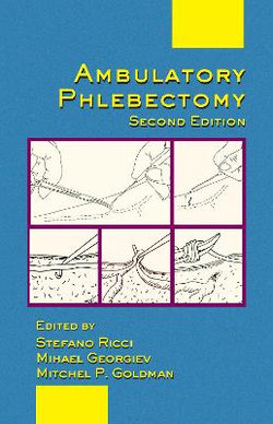 Ambulatory Phlebectomy