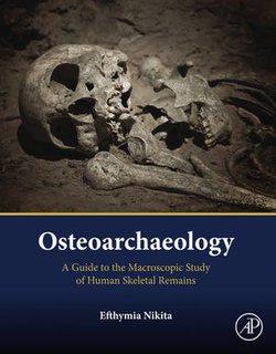 Osteoarchaeology