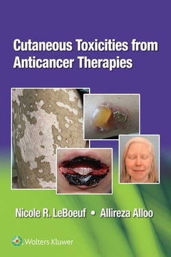 Cutaneous Reactions from Anti-Cancer Therapies