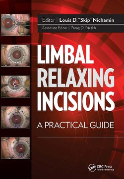 Limbal Relaxing Incisions