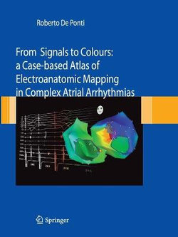 From Signals to Colours