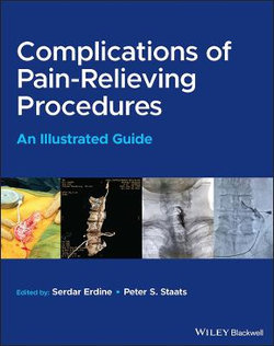 Complications of Pain-Relieving Procedures