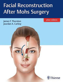 Facial Reconstruction After Mohs Surgery