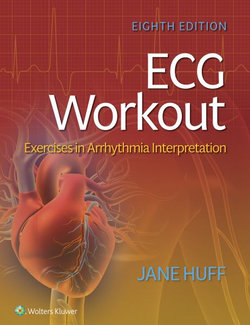 ECG Workout 8ed