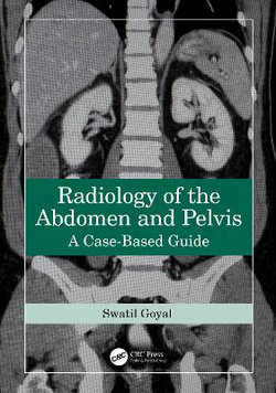 Radiology of the Abdomen and Pelvis