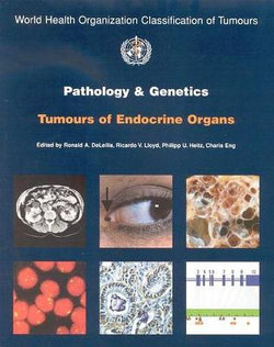 Pathology and genetics of tumours of the endocrine organs