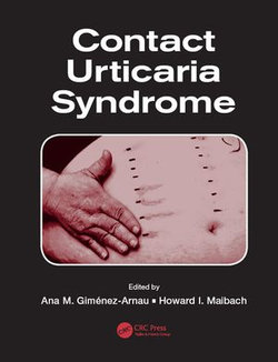 Contact Urticaria Syndrome