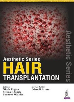 Aesthetic Series - Hair Transplantation