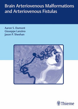 Brain Arteriovenous Malformations and Arteriovenous Fistulas