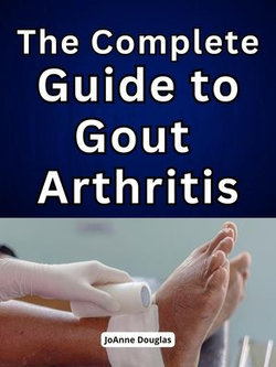 The Complete Guide to Gout Arthritis