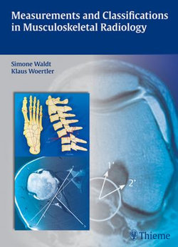 Measurements and Classifications in Musculoskeletal Radiology