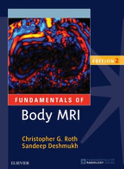 Fundamentals of Body MRI E-Book