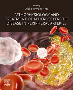 Pathophysiology and Treatment of Atherosclerotic Disease in Peripheral Arteries