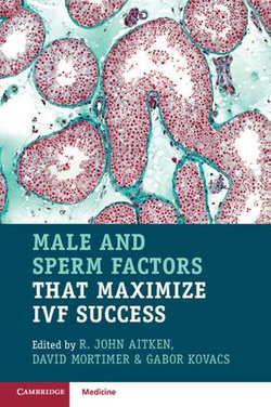 Male and Sperm Factors that Maximize IVF Success