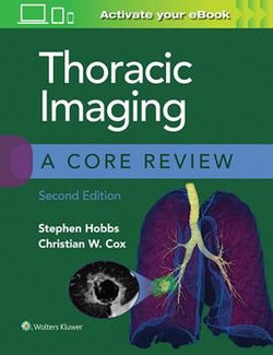 Thoracic Imaging 2ed