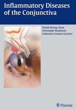 Inflammatory Diseases of the Conjuctiva