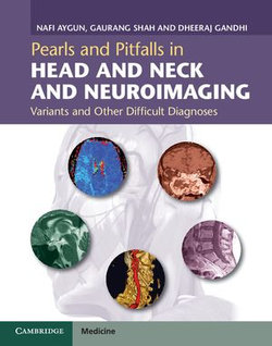 Pearls and Pitfalls in Head and Neck and Neuroimaging