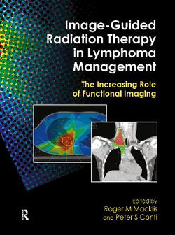 Image-Guided Radiation Therapy in Lymphoma Management