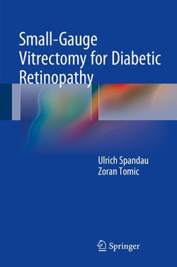 Small-Gauge Vitrectomy for Diabetic Retinopathy