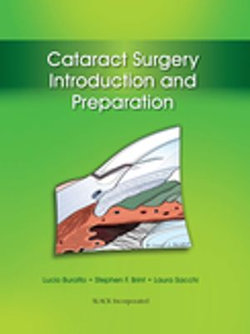 Cataract Surgery