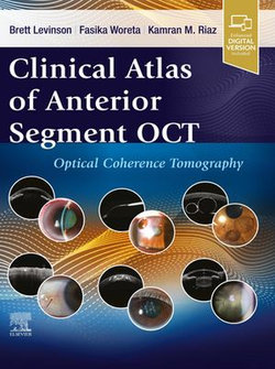 Clinical Atlas of Anterior Segment OCT: Ocular Coherence Tomography - E-Book