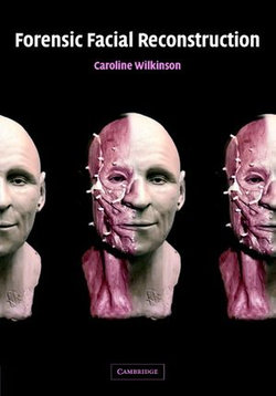 Forensic Facial Reconstruction