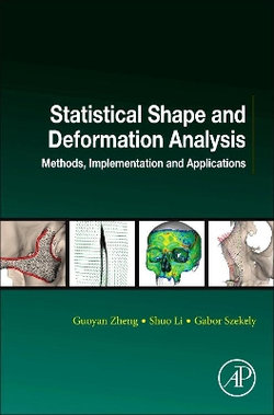 Statistical Shape and Deformation Analysis