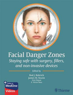 Facial Danger Zones