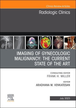 Imaging of Gynecologic Malignancy: The Current State of the Art, An Issue of Radiologic Clinics of North America, E-Book