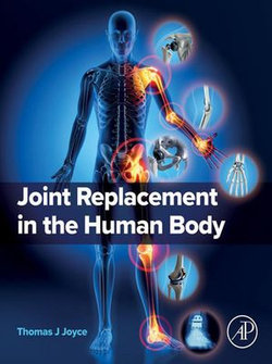 Joint Replacement in the Human Body