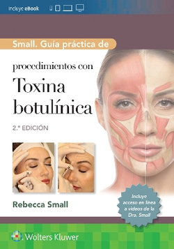 Small. Guía Práctica De Procedimientos Con Toxina Botulínica