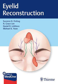 Eyelid Reconstruction