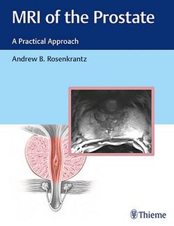 MRI of the Prostate