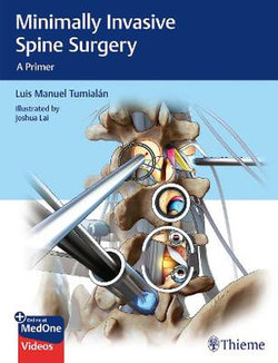 Minimally Invasive Spine Surgery