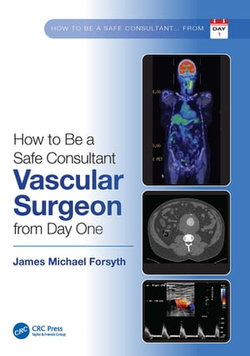 How to be a Safe Consultant Vascular Surgeon from Day One