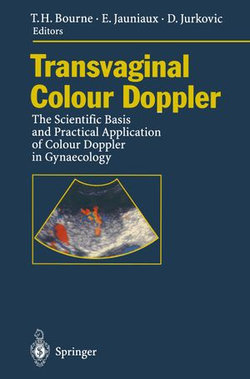 Transvaginal Colour Doppler