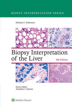 Biopsy Interpretation of the Liver