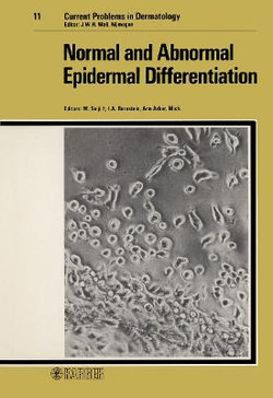 Normal and Abnormal Epidermal Differentiation