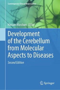 Development of the Cerebellum from Molecular Aspects to Diseases